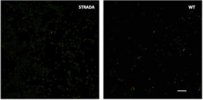Multimodal Analysis of STRADA Function in Brain Development